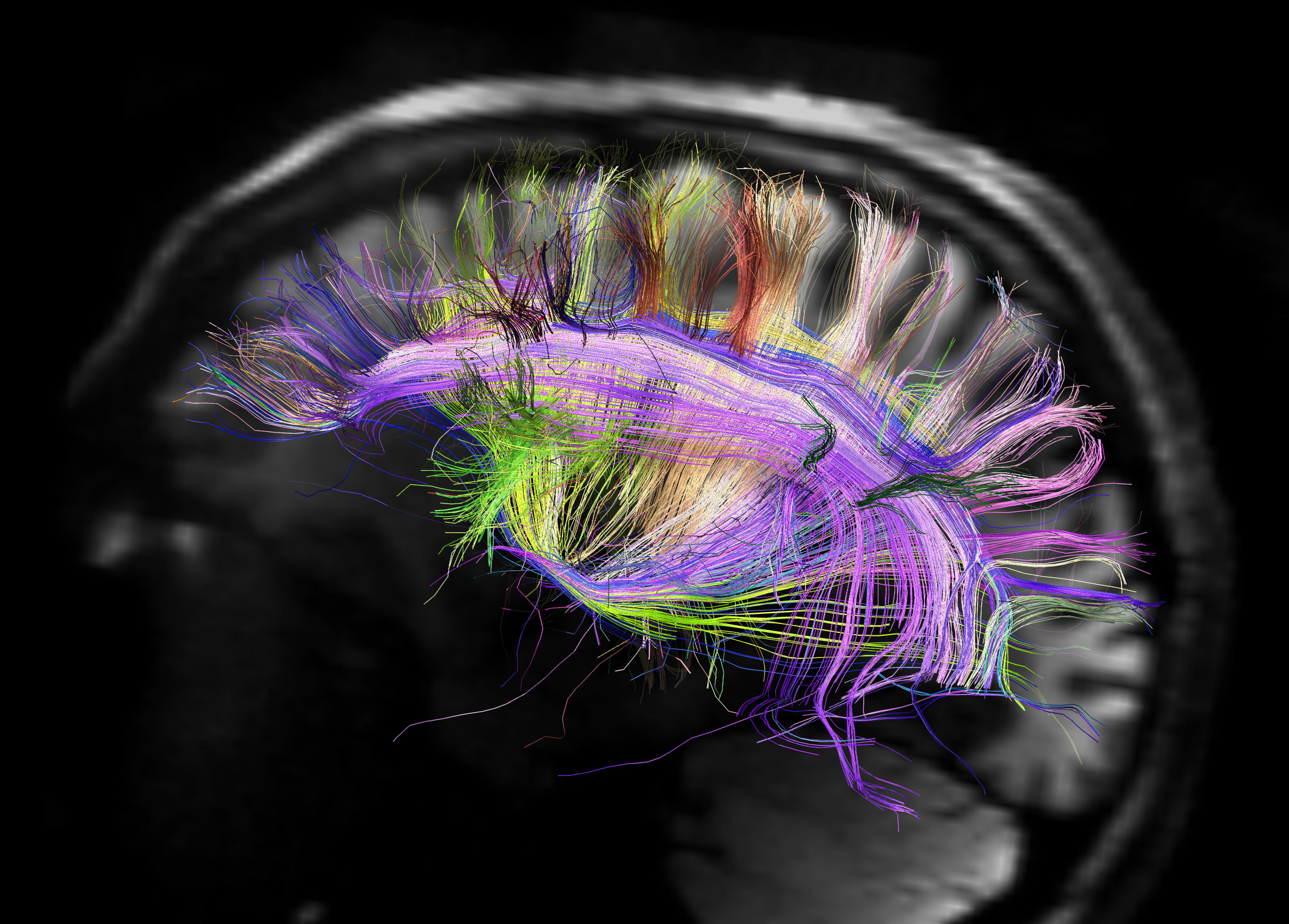 Pioneer Brand Strategist Megan Kent Reinvents Brand Strategy Through Brain Science